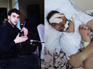 Էլիտան չի հանդուրժում քննադատություն